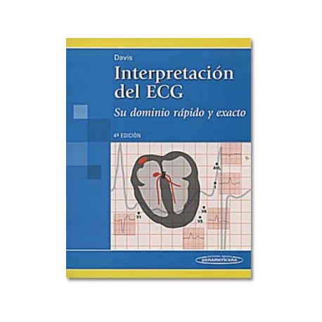 Interpretación del ECG ( Panamericana)