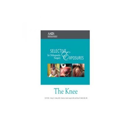 SEOS: Knee 2nd