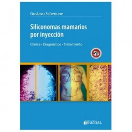 Siliconomas Mamarios por Inyección (Journal)