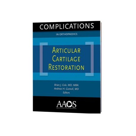 Complications in Orthopaedics: Articular Cartilage Restoration