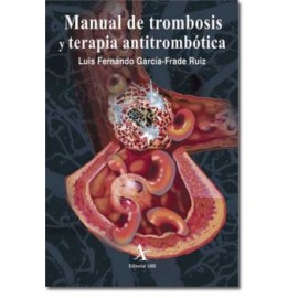 Manual de trombosis y terapia antitrombótica