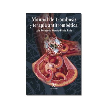 Manual de trombosis y terapia antitrombótica