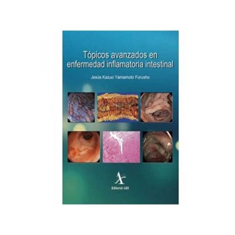 Tópicos Avanzados en Enfermedad Inflamatoria Intestinal (Alfil)