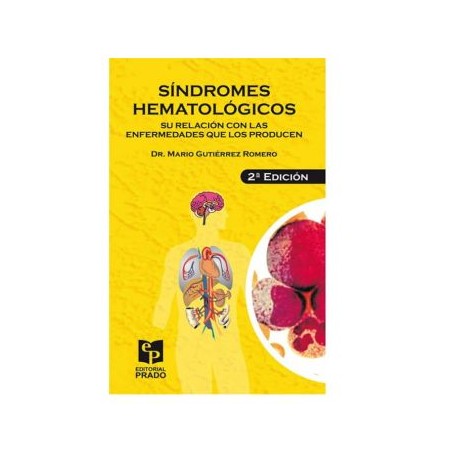 Síndromes hematológicos. (Prado)