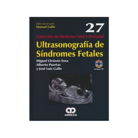 Ultrasonografía de síndromes fetales (Amolca)