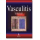 Vasculitis