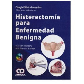 Histerectomía para enfermedad benigna (Amolca)