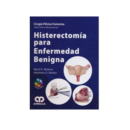 Histerectomía para enfermedad benigna (Amolca)