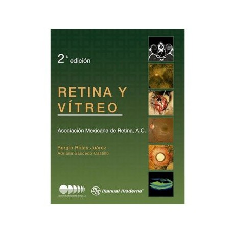 Retina y vítreo (Manual Moderno)