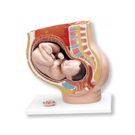 Pelvis de embarazo L20 (1000333)