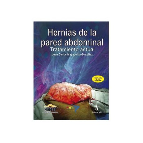 Hernias de la pared abdominal