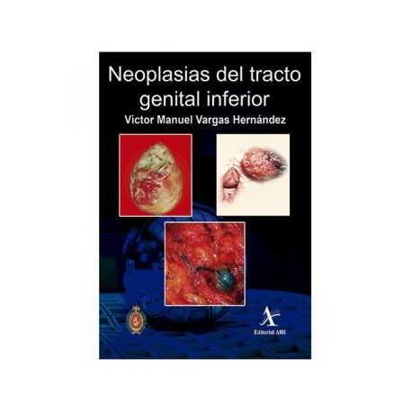 Neoplasias del tracto genital inferior (Alfil)