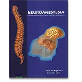 Neuroanestesia.  Enfoque Perioperatorio en en Paciente Neurológico