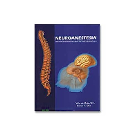 Neuroanestesia.  Enfoque Perioperatorio en en Paciente Neurológico