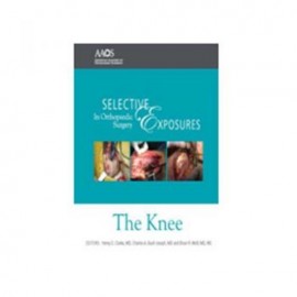SEOS: Knee 2nd