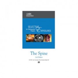 SEOS: Spine 2nd