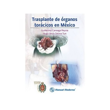 Trasplante de órganos torácicos en México (Manual Moderno)
