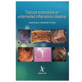 Tópicos Avanzados en Enfermedad Inflamatoria Intestinal (Alfil)
