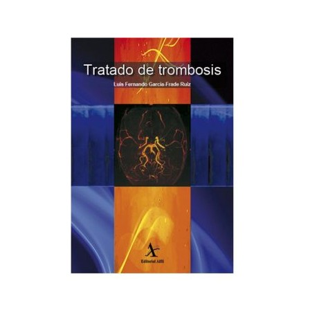 Tratado de trombosis