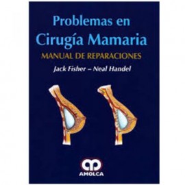 Problemas de cirugía mamaria. Manual de reparaciones (Amolca)