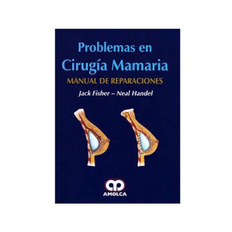 Problemas de cirugía mamaria. Manual de reparaciones (Amolca)