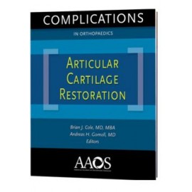 Complications in Orthopaedics: Articular Cartilage Restoration