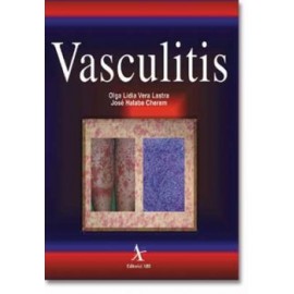 Vasculitis