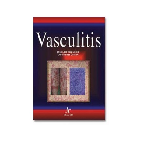 Vasculitis