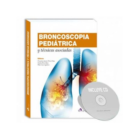 Broncoscopia pediátrica técnicas asociadas