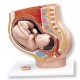 Pelvis de embarazo L20 (1000333)