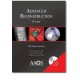 Advance Reconstruction: Knee