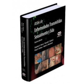 Atlas de enfermedades transmitidas sexualmente y SIDA ( Amolca)