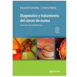 Diagnóstico y Tratamiento del Cáncer de Mama: Guía de Procedimientos (Journal)