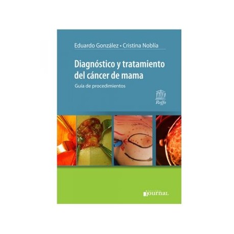 Diagnóstico y Tratamiento del Cáncer de Mama: Guía de Procedimientos (Journal)