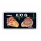 ECG Electrocardiografía (Marbán)