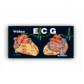 ECG Electrocardiografía (Marbán)