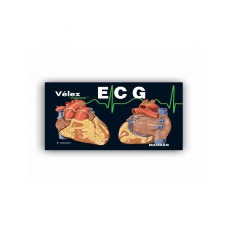 ECG Electrocardiografía (Marbán)