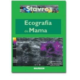 Ecografía de mama (Marbán)