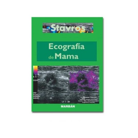 Ecografía de mama (Marbán)