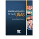 Enfermedades de las uñas (Masson)
