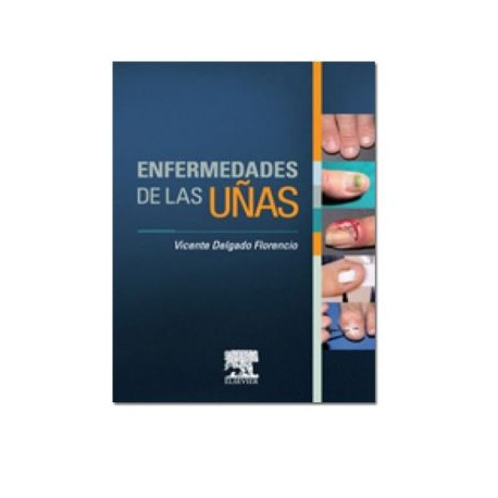 Enfermedades de las uñas (Masson)