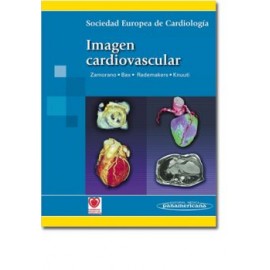 Imagen cardiovascular (Panamericana)