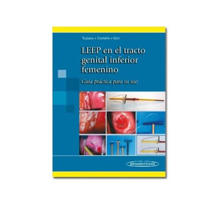 LEEP en el tracto genital inferior femenino (  Panamericana)