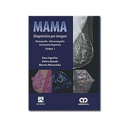 Mama Diagnóstico por imagen (Amolca)