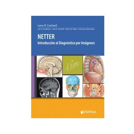 Netter. Introducción al Diagnostico por Imágenes (Journal)