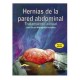 Hernias de la pared abdominal