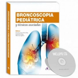 Broncoscopia pediátrica técnicas asociadas