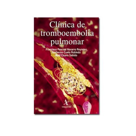 Clínica de tromboembolia pulmonar