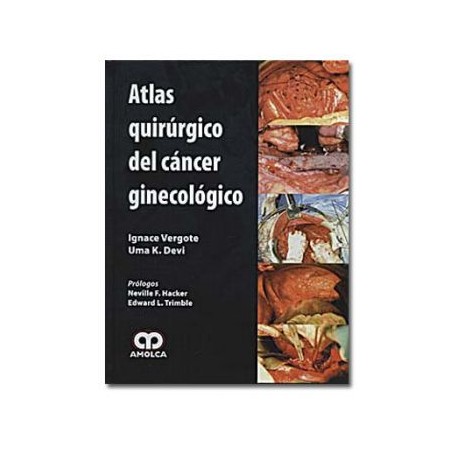 Atlas quirúrgico del cáncer ginecológico