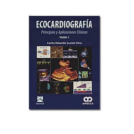 Ecocardiografía Principios y aplicaciones clínicas (Amolca)